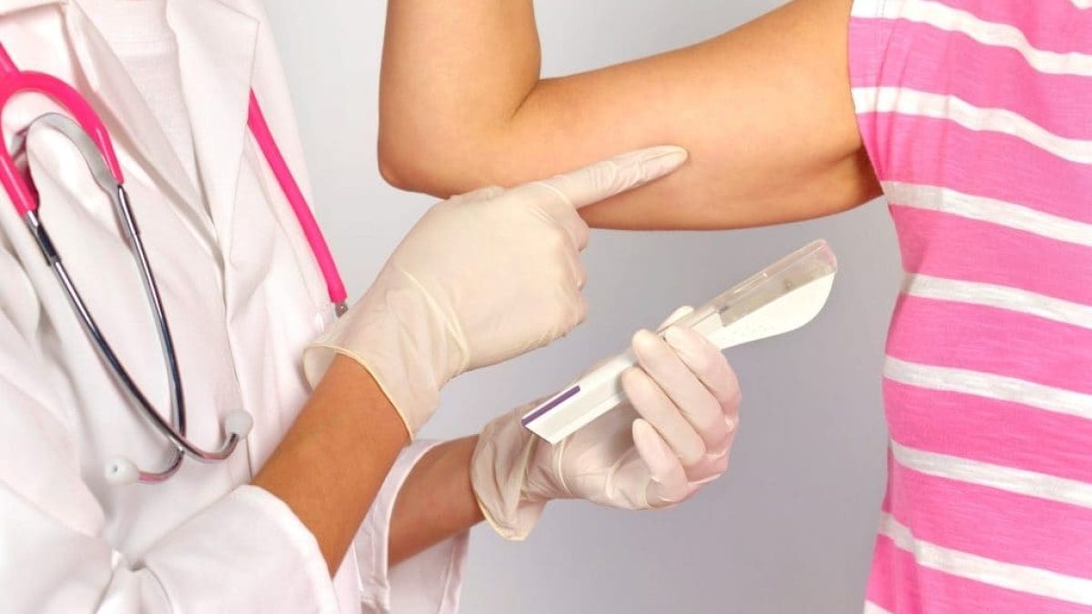 Implanon chega ao SUS e mostra sua importância na aquisição demétodos contraceptivos